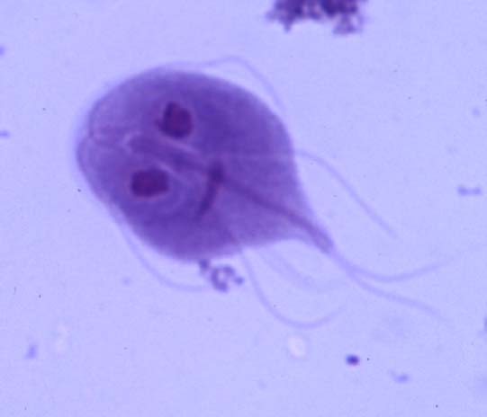 giardiasis diagnóstico